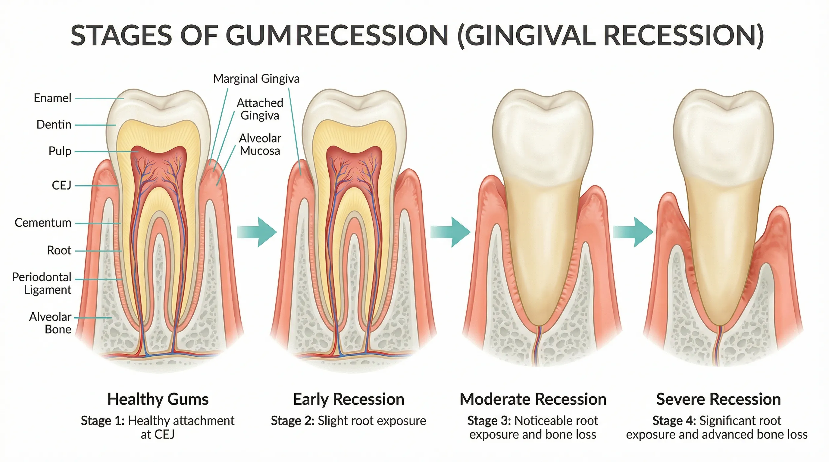 Natural methods for reversing early-stage gum disease